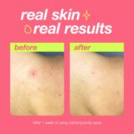 Dermalogica Clarifying Body Spray Jumbo (295ml) – product image 3