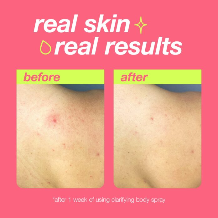 Dermalogica Clarifying Body Spray Jumbo (295ml) – product image 3